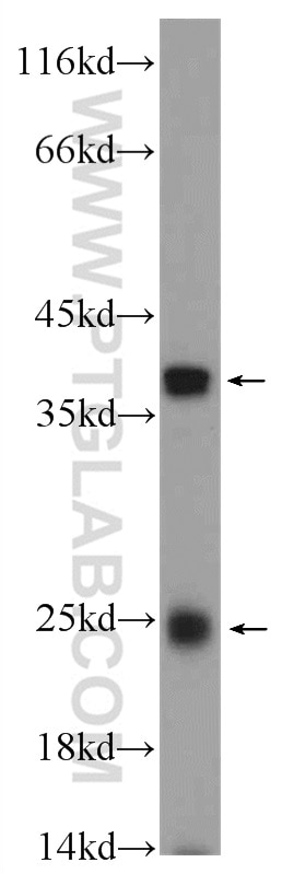 Western Blot (WB) analysis of mouse colon tissue using TMEM9B Polyclonal antibody (24331-1-AP)