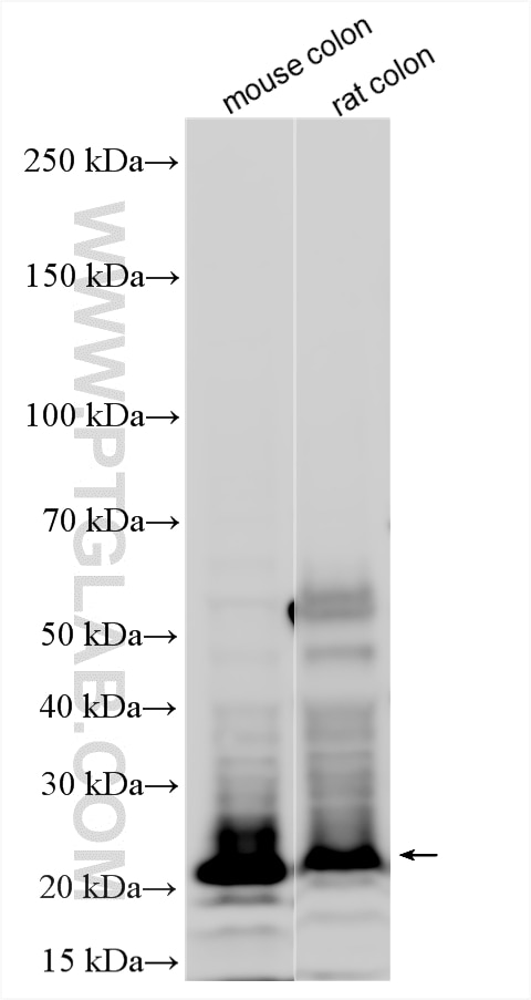 Western Blot (WB) analysis of various lysates using TMEM9B Polyclonal antibody (24331-1-AP)