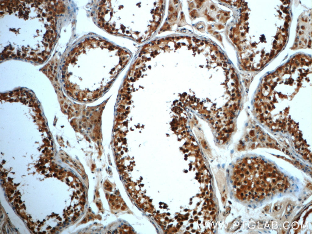 Immunohistochemistry (IHC) staining of human testis tissue using TMF1 Polyclonal antibody (22212-1-AP)