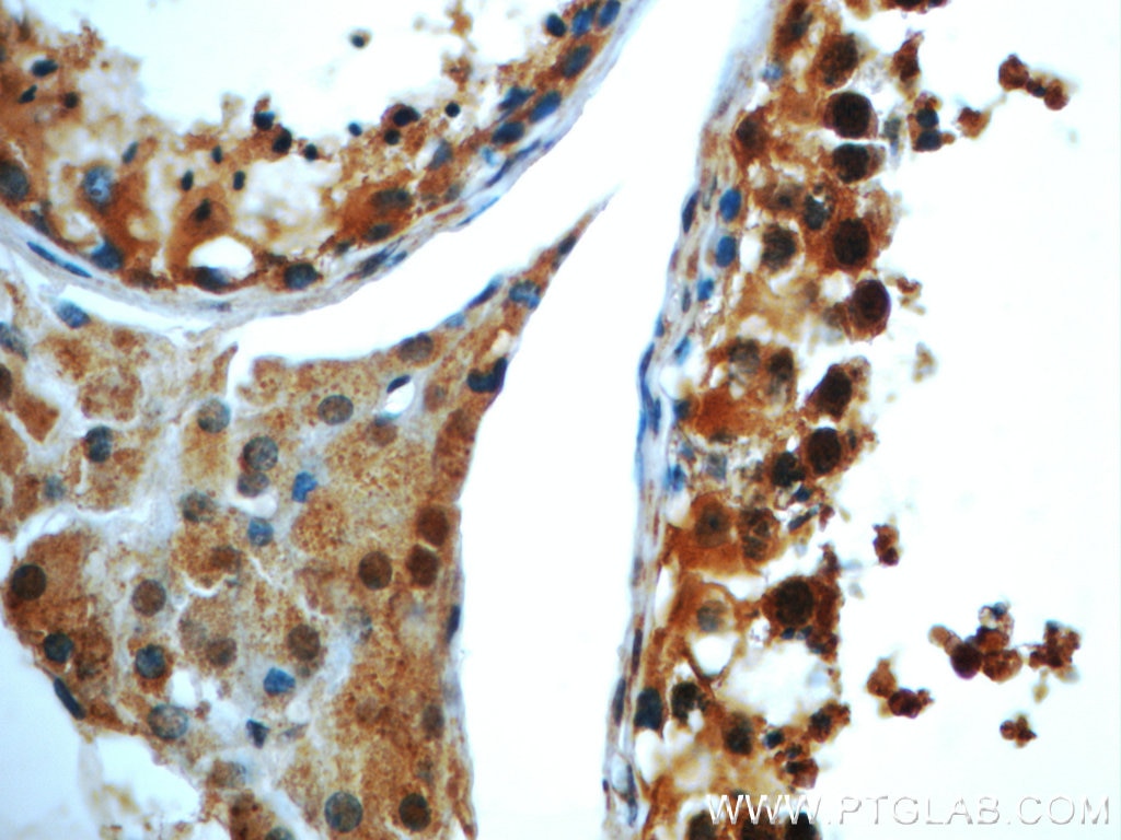 IHC staining of human testis using 22212-1-AP