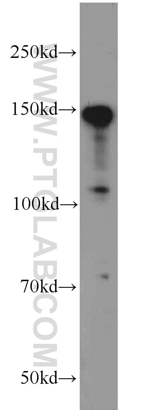 Western Blot (WB) analysis of rat brain tissue using TMF1 Polyclonal antibody (22212-1-AP)