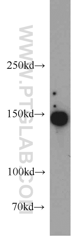 WB analysis of mouse brain using 22212-1-AP