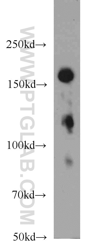 Western Blot (WB) analysis of mouse colon tissue using TMF1 Polyclonal antibody (22212-1-AP)