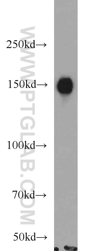 Western Blot (WB) analysis of Jurkat cells using TMF1 Polyclonal antibody (22212-1-AP)