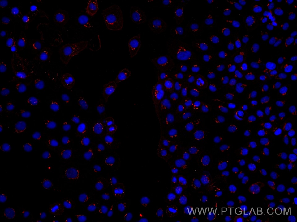 Immunofluorescence (IF) / fluorescent staining of A431 cells using TMF1 Monoclonal antibody (67505-1-Ig)