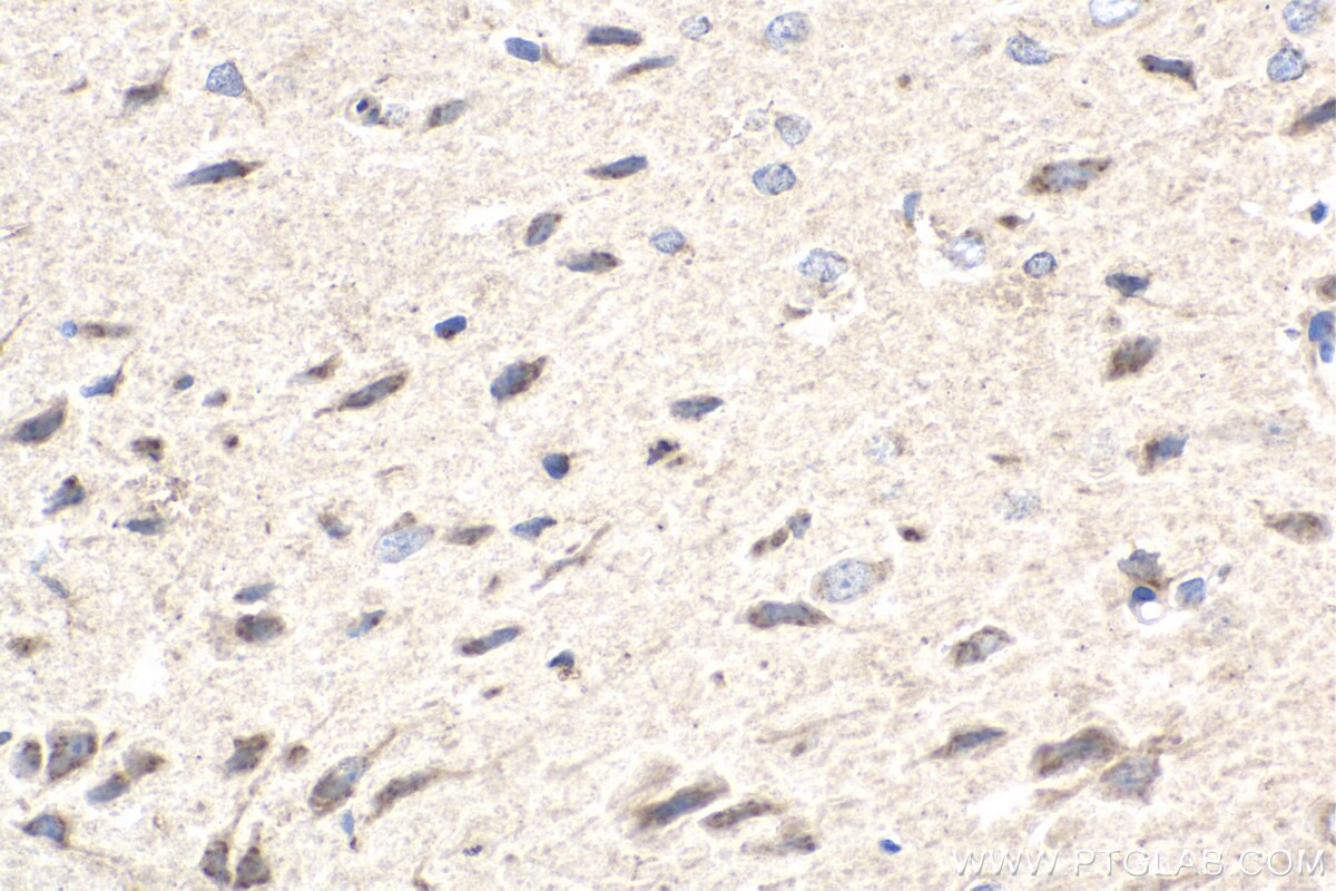 Immunohistochemistry (IHC) staining of rat brain tissue using TMF1 Monoclonal antibody (67505-1-Ig)
