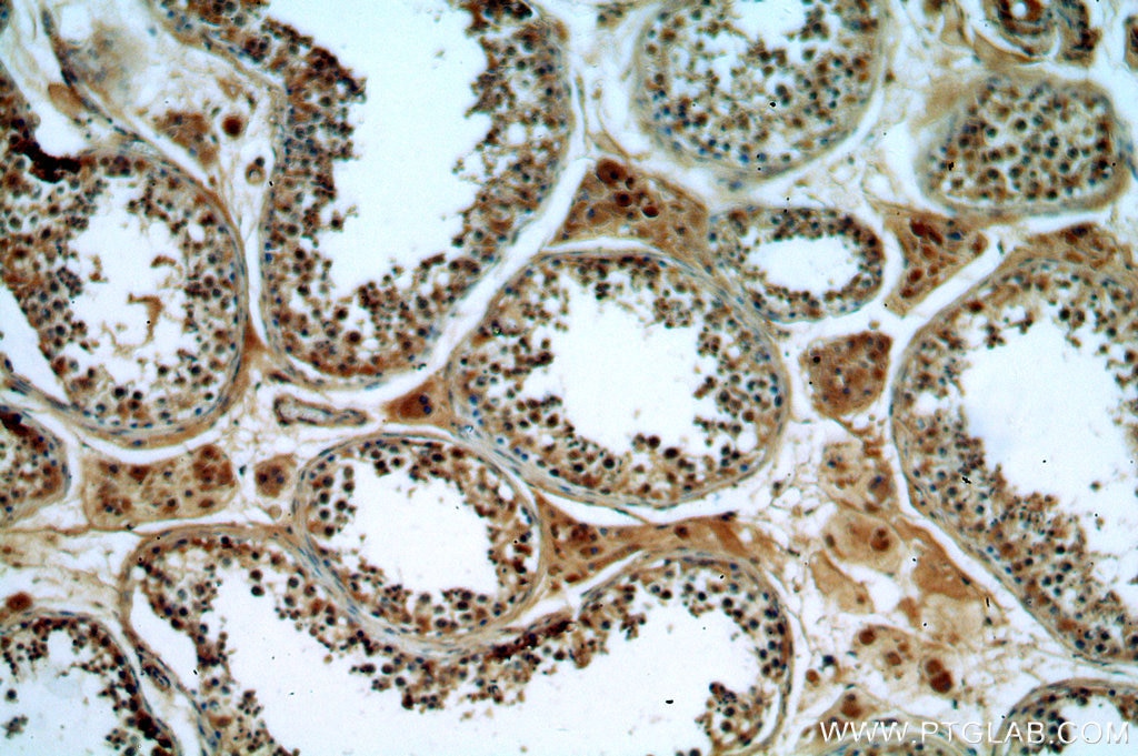 Immunohistochemistry (IHC) staining of human testis tissue using TMF1-Specific Polyclonal antibody (19728-1-AP)