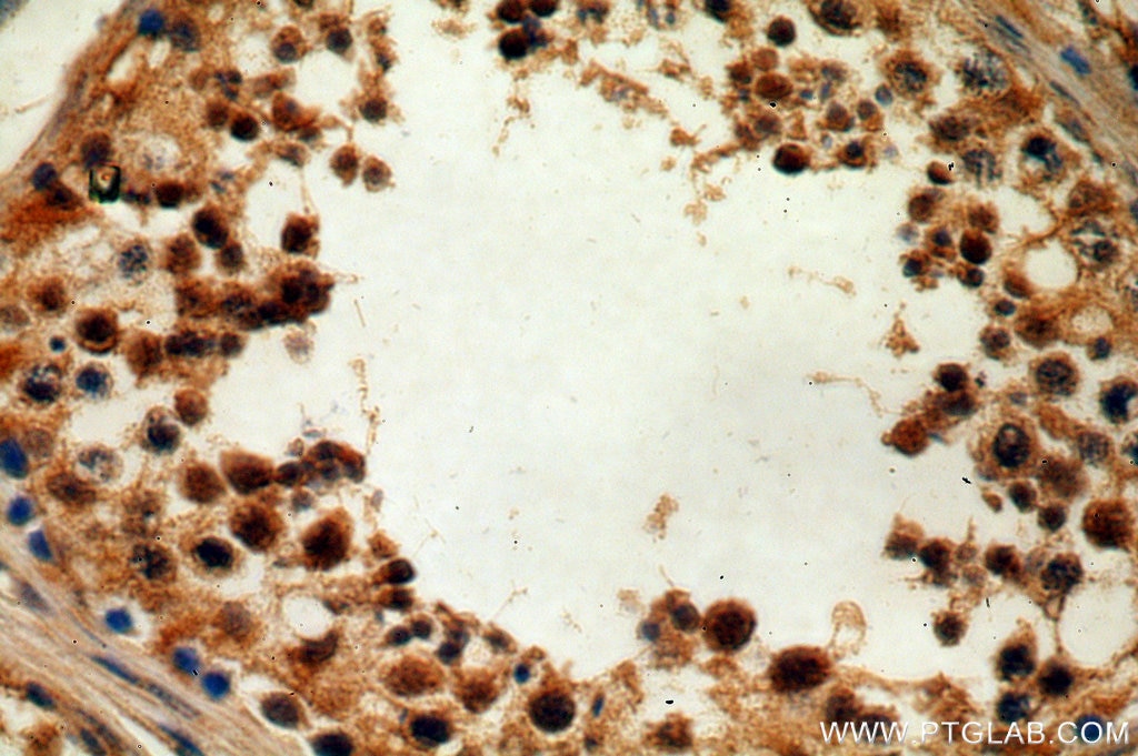 Immunohistochemistry (IHC) staining of human testis tissue using TMF1-Specific Polyclonal antibody (19728-1-AP)