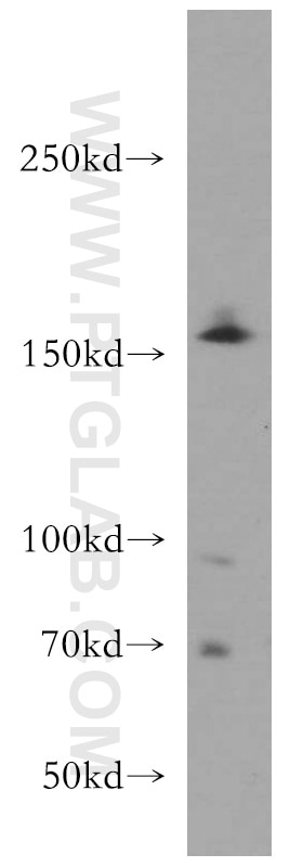 Western Blot (WB) analysis of BxPC-3 cells using TMF1-Specific Polyclonal antibody (19728-1-AP)