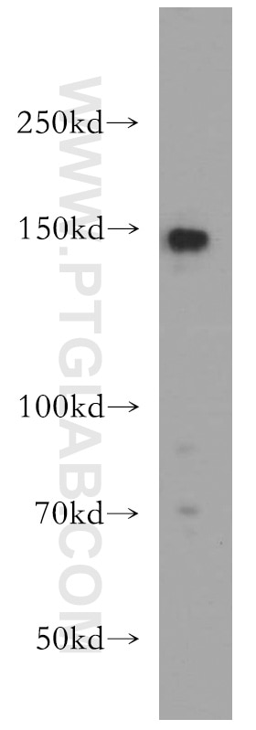 Western Blot (WB) analysis of L02 cells using TMF1-Specific Polyclonal antibody (19728-1-AP)