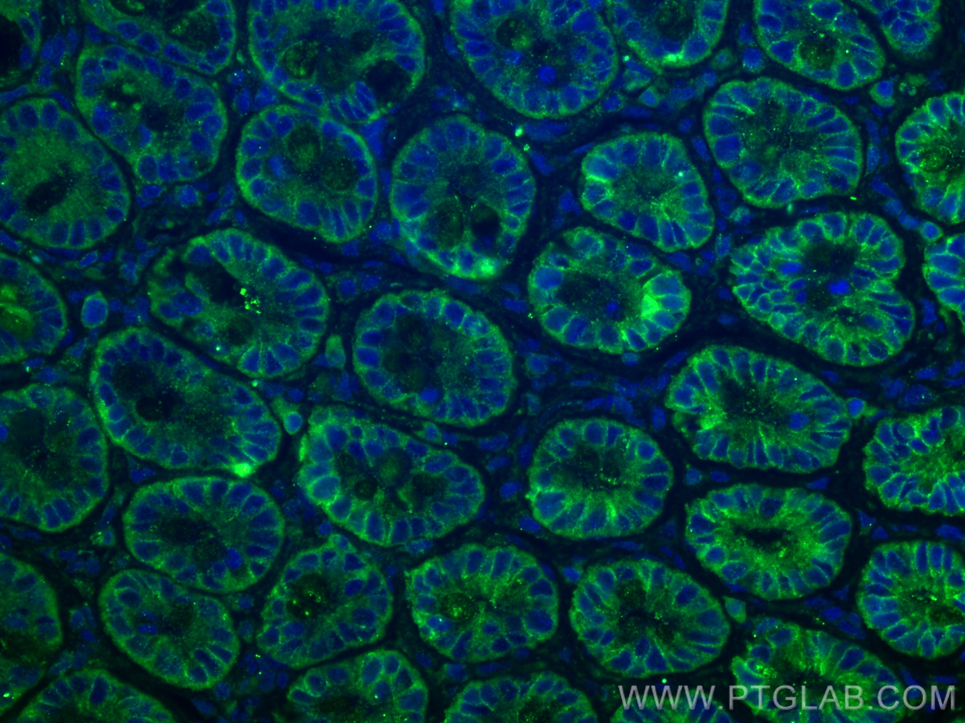 Immunofluorescence (IF) / fluorescent staining of rat small intestine tissue using TMIGD1 Polyclonal antibody (27174-1-AP)