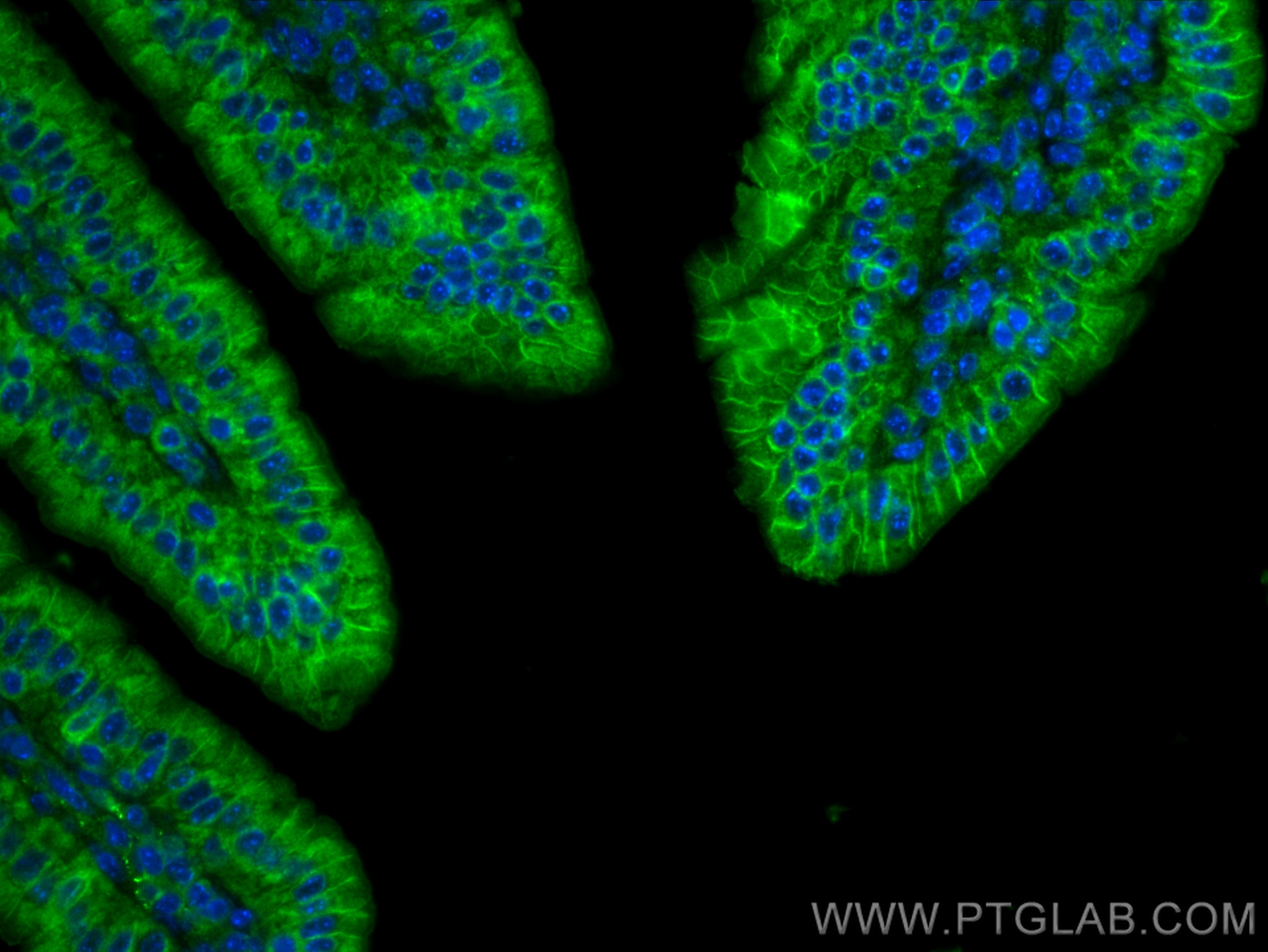 Immunofluorescence (IF) / fluorescent staining of mouse small intestine tissue using TMIGD1 Polyclonal antibody (27174-1-AP)