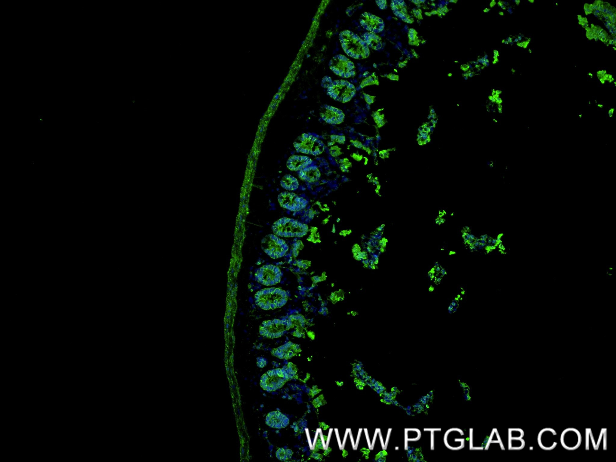 IF Staining of mouse small intestine using 84130-6-RR (same clone as 84130-6-PBS) Immunofluorescence (IF) / fluorescent staining of mouse small intestine tissue using TMIGD1 Recombinant monoclonal antibody (84130-6-RR)