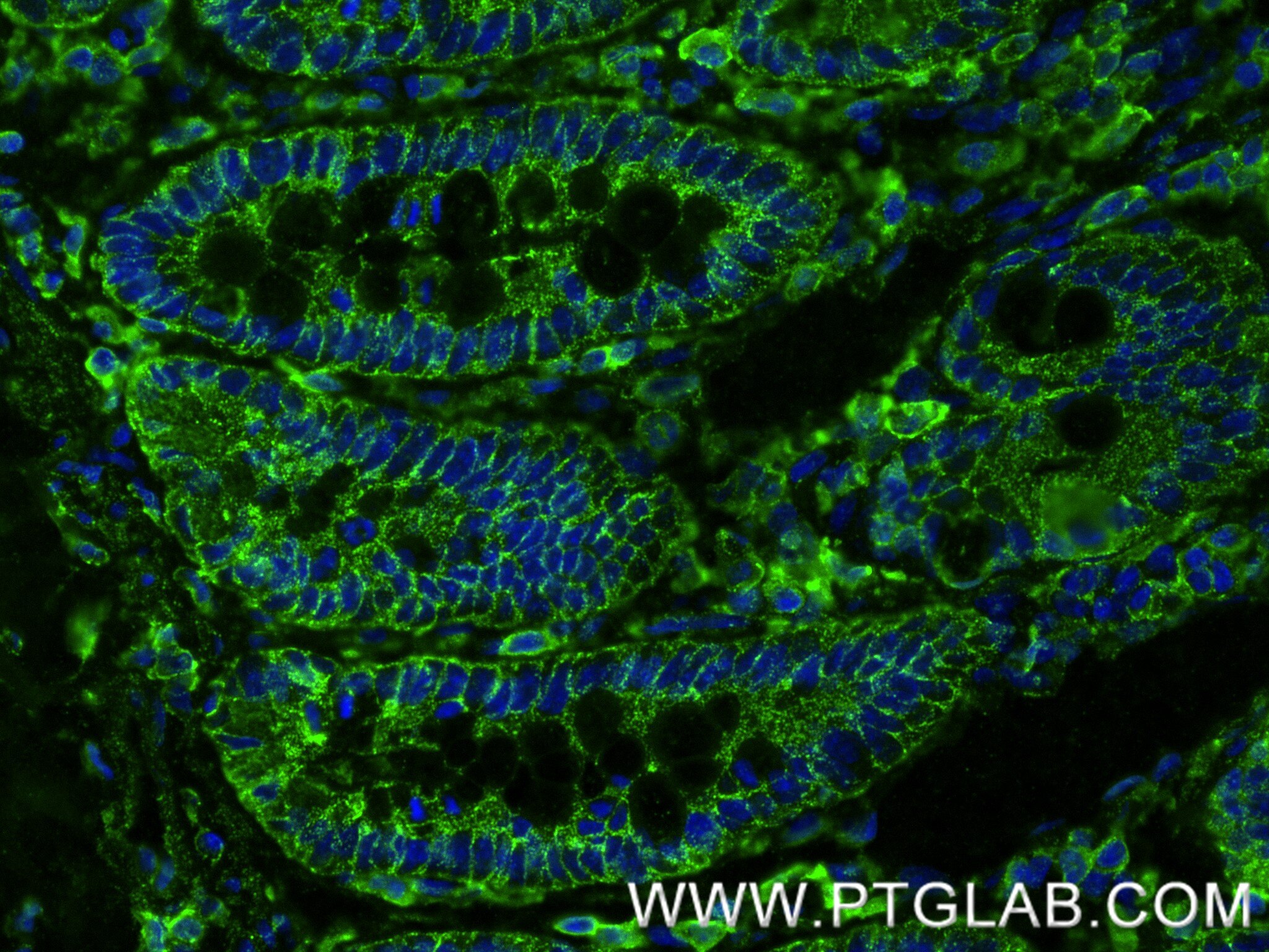 IF Staining of rat small intestine using 84130-6-RR (same clone as 84130-6-PBS) Immunofluorescence (IF) / fluorescent staining of rat small intestine tissue using TMIGD1 Recombinant monoclonal antibody (84130-6-RR)