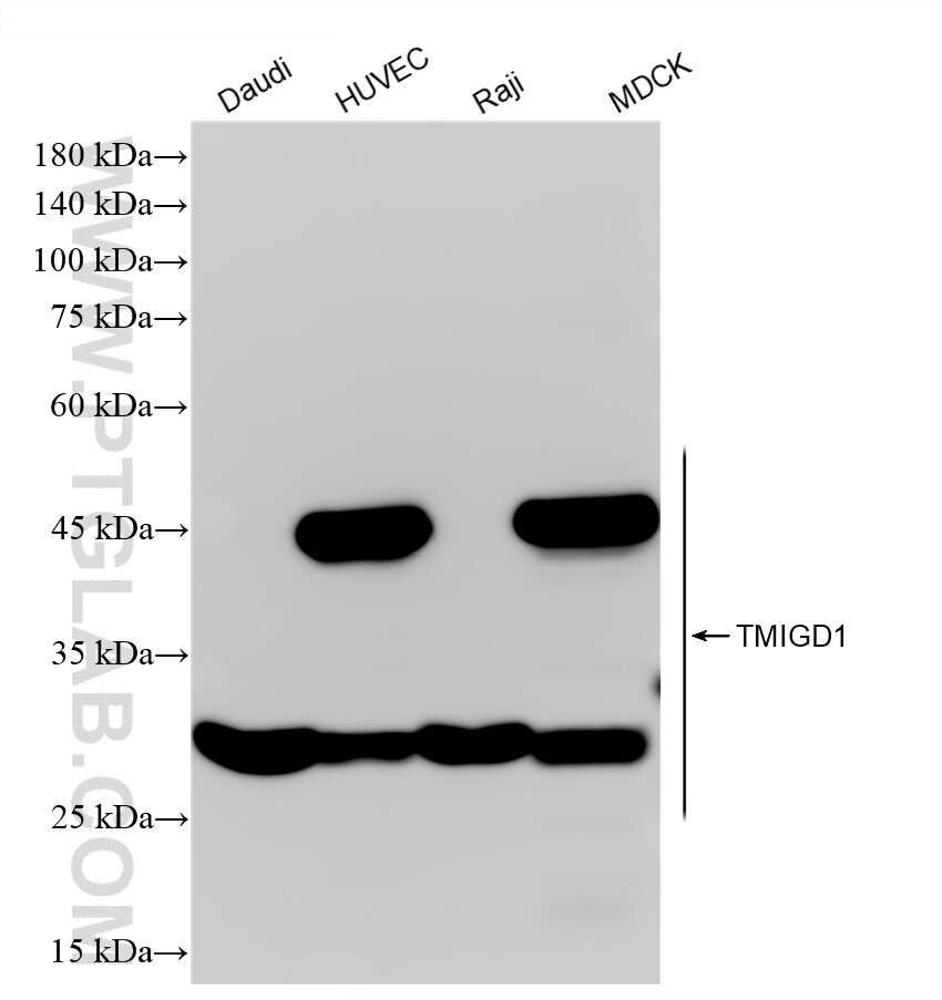 WB analysis using 84130-6-RR (same clone as 84130-6-PBS) Western Blot (WB) analysis of various lysates using TMIGD1 Recombinant monoclonal antibody (84130-6-RR)