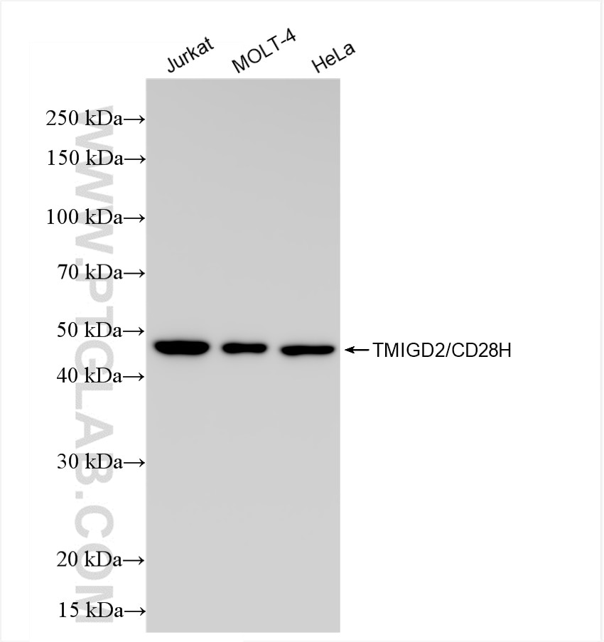 Western Blot (WB) analysis of various lysates using TMIGD2/CD28H Recombinant antibody (84727-5-RR)