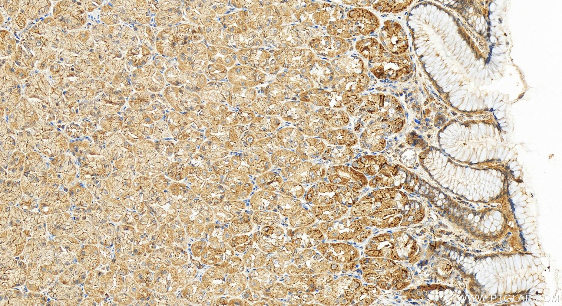Immunohistochemistry (IHC) staining of human stomach tissue using TMLHE Polyclonal antibody (16621-1-AP)