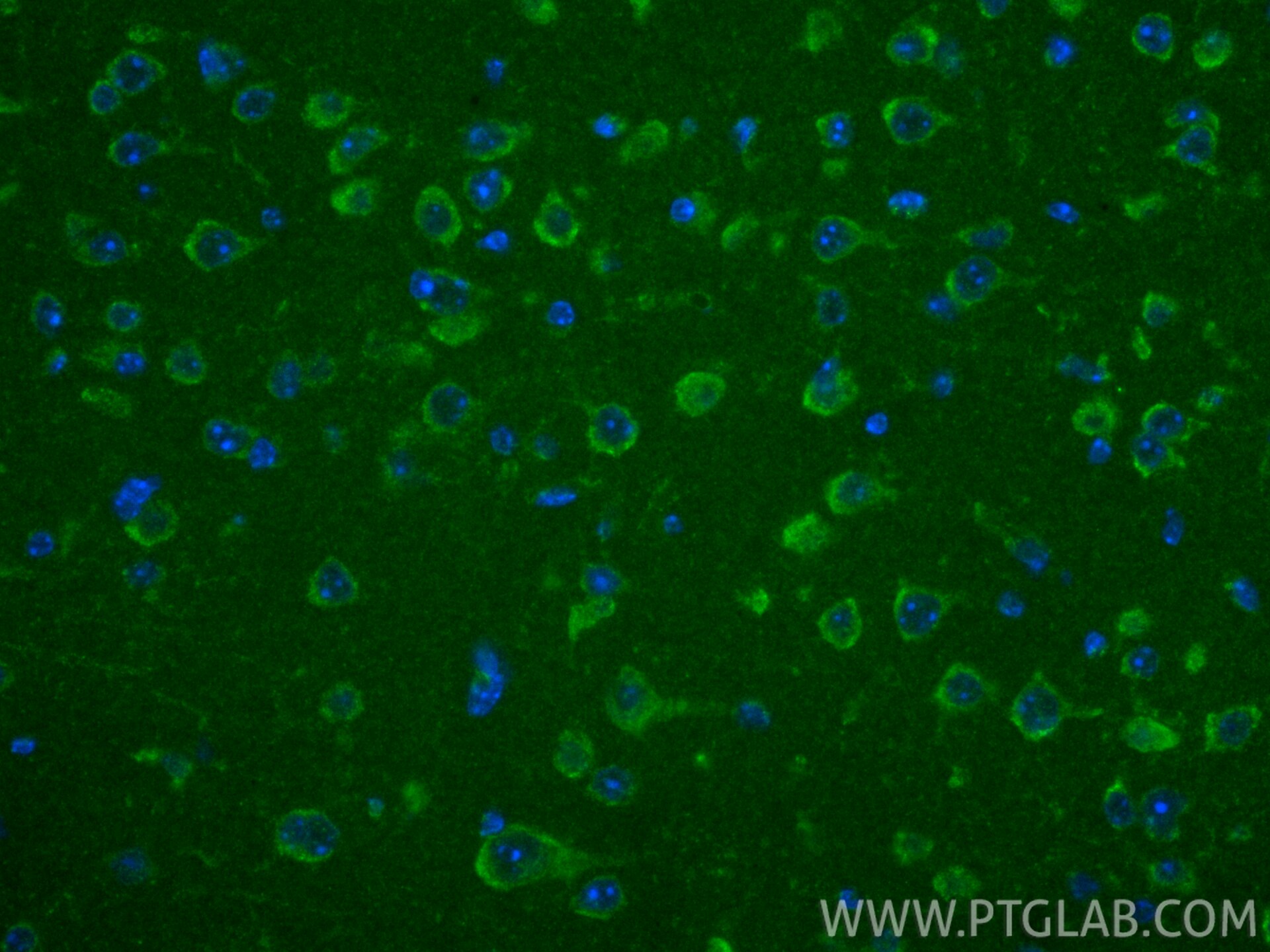 IF Staining of mouse brain using 16621-1-AP Immunofluorescence (IF) / fluorescent staining of mouse brain tissue using TMLHE Polyclonal antibody (16621-1-AP)