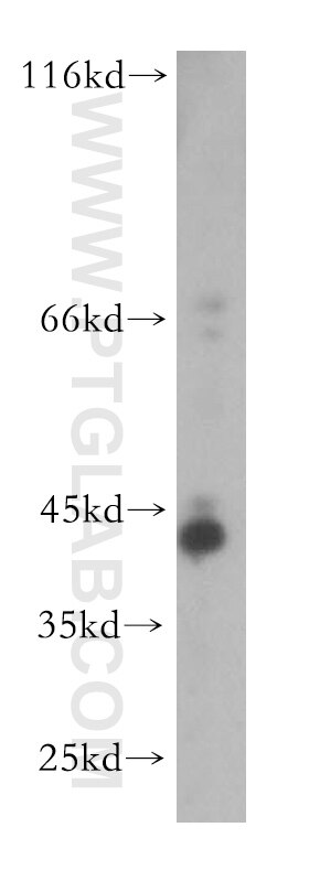 Western Blot (WB) analysis of human liver tissue using TMLHE Polyclonal antibody (16621-1-AP)