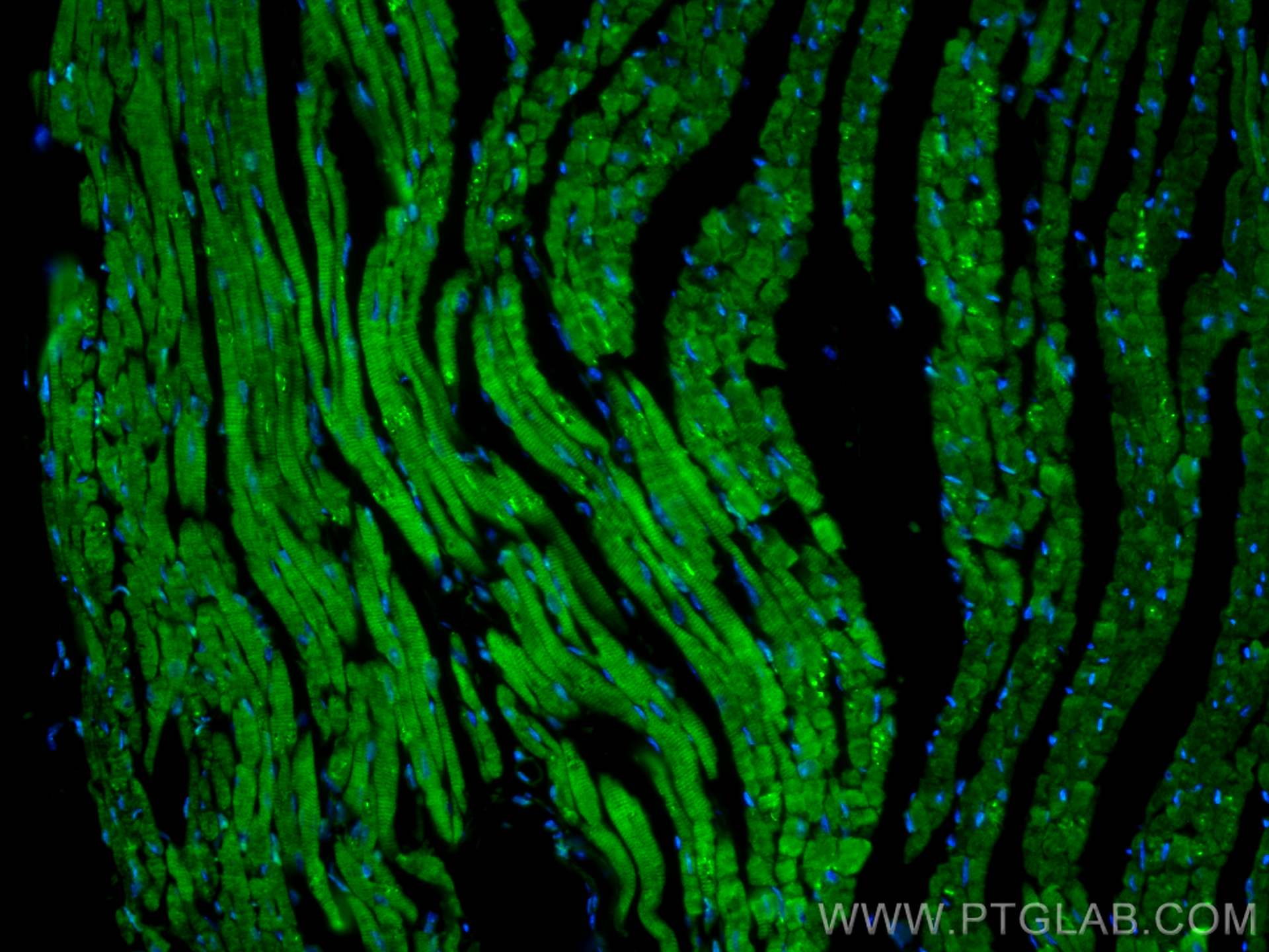 Immunofluorescence (IF) / fluorescent staining of mouse heart tissue using TMOD1 Polyclonal antibody (10145-1-AP)
