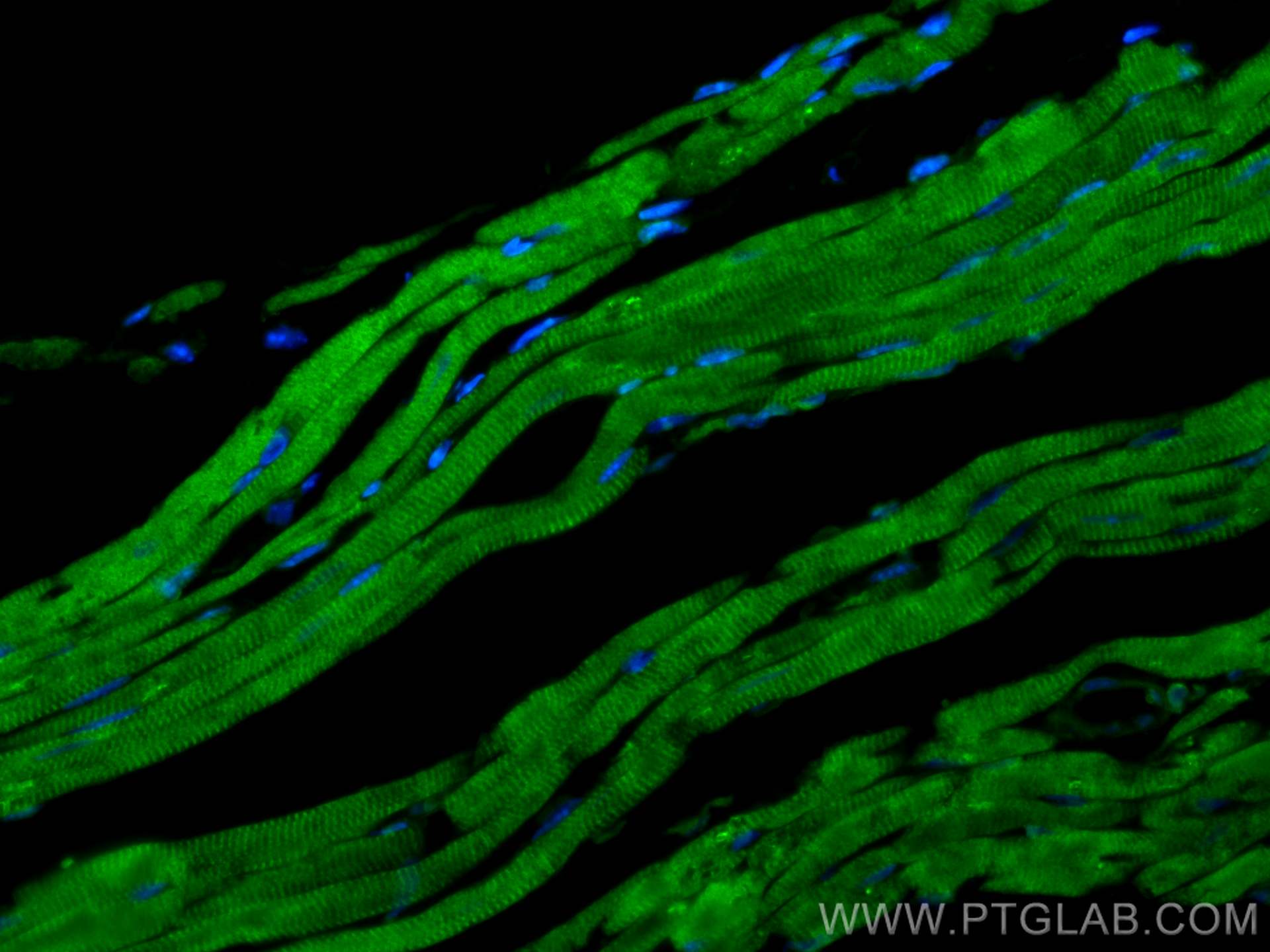 Immunofluorescence (IF) / fluorescent staining of mouse heart tissue using TMOD1 Polyclonal antibody (10145-1-AP)