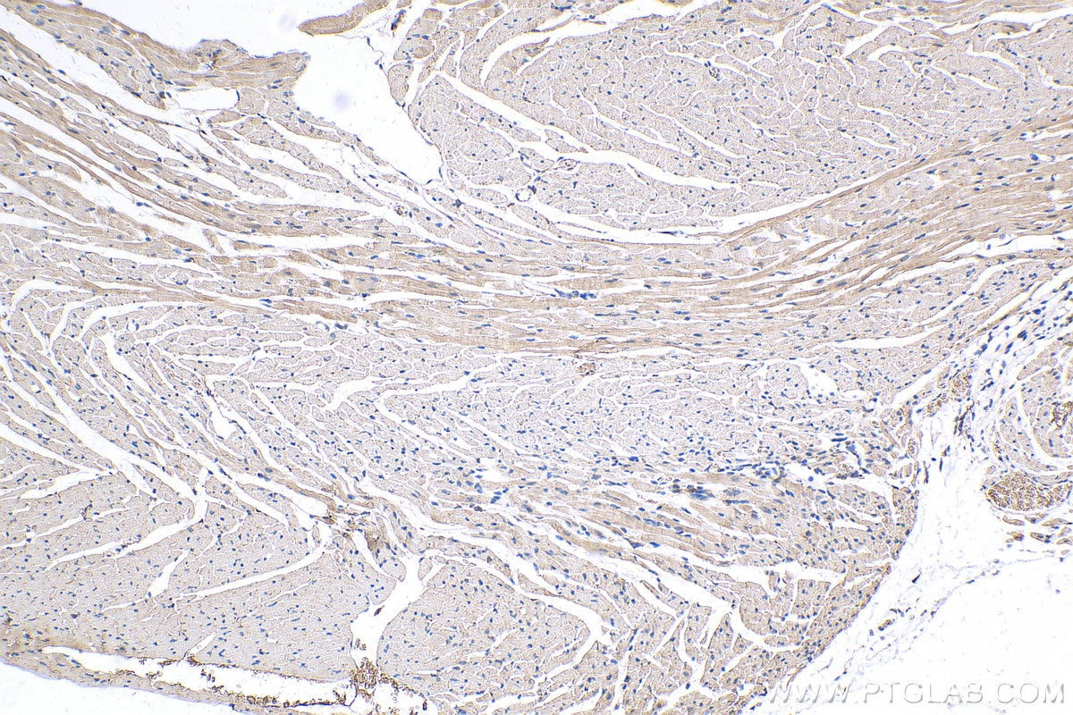 Immunohistochemistry (IHC) staining of mouse heart tissue using TMOD1 Polyclonal antibody (10145-1-AP)