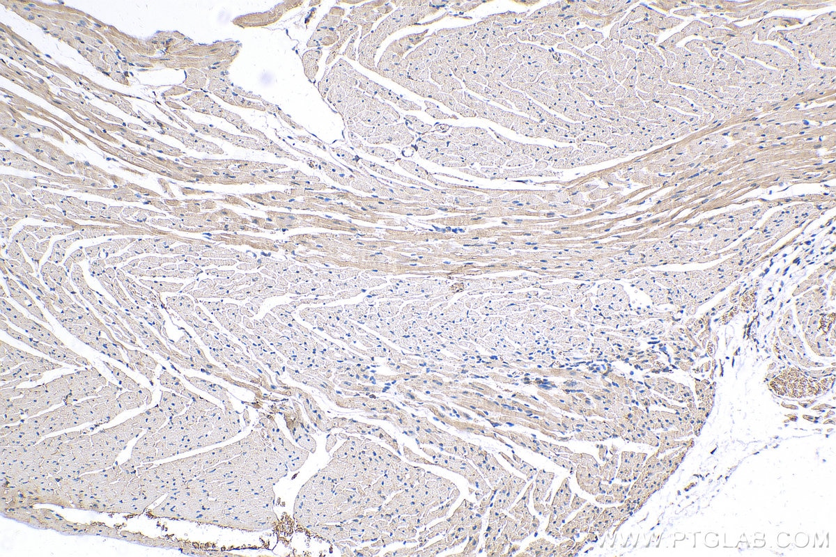 Immunohistochemistry (IHC) staining of mouse heart tissue using TMOD1 Polyclonal antibody (10145-1-AP)