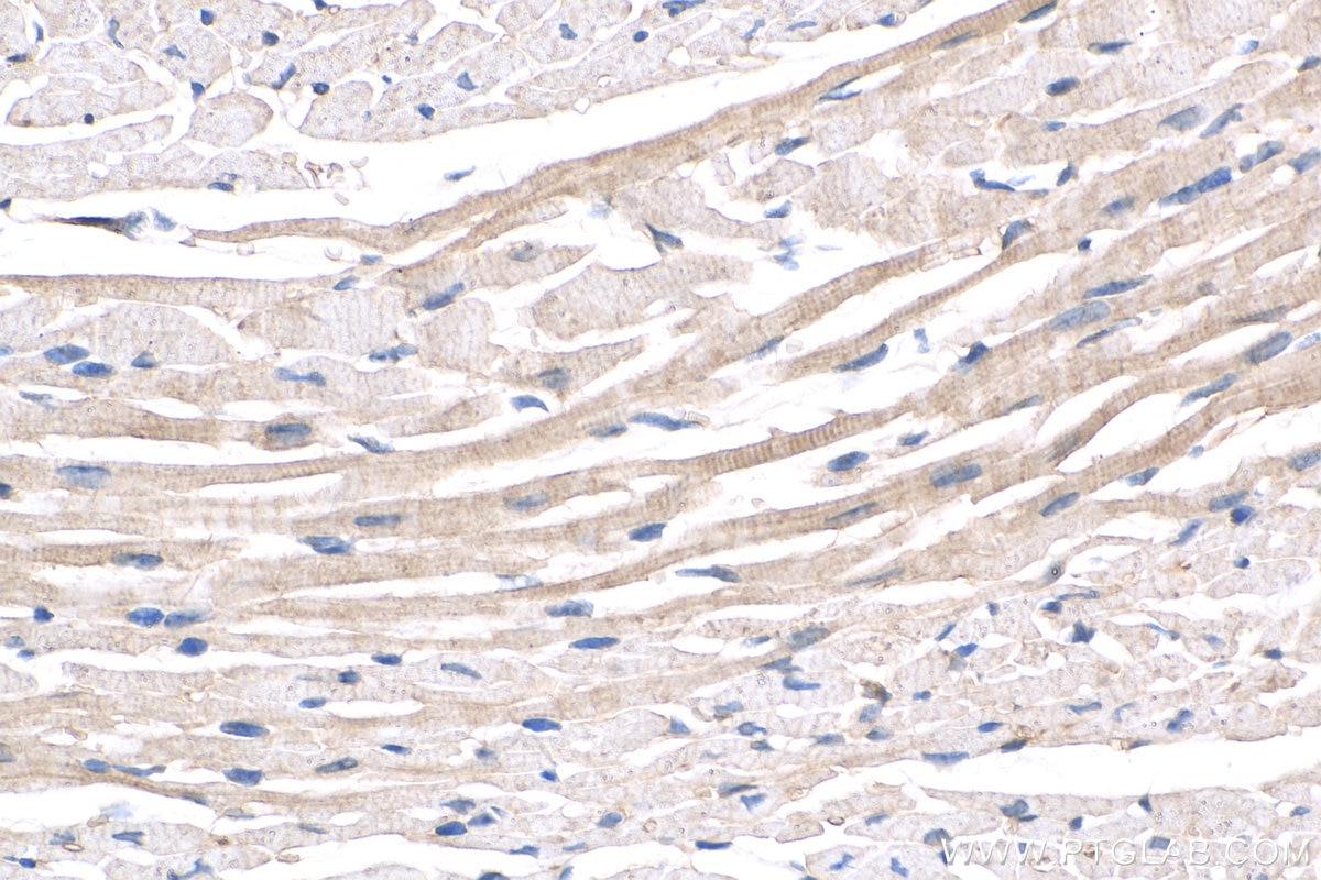 Immunohistochemistry (IHC) staining of mouse heart tissue using TMOD1 Polyclonal antibody (10145-1-AP)