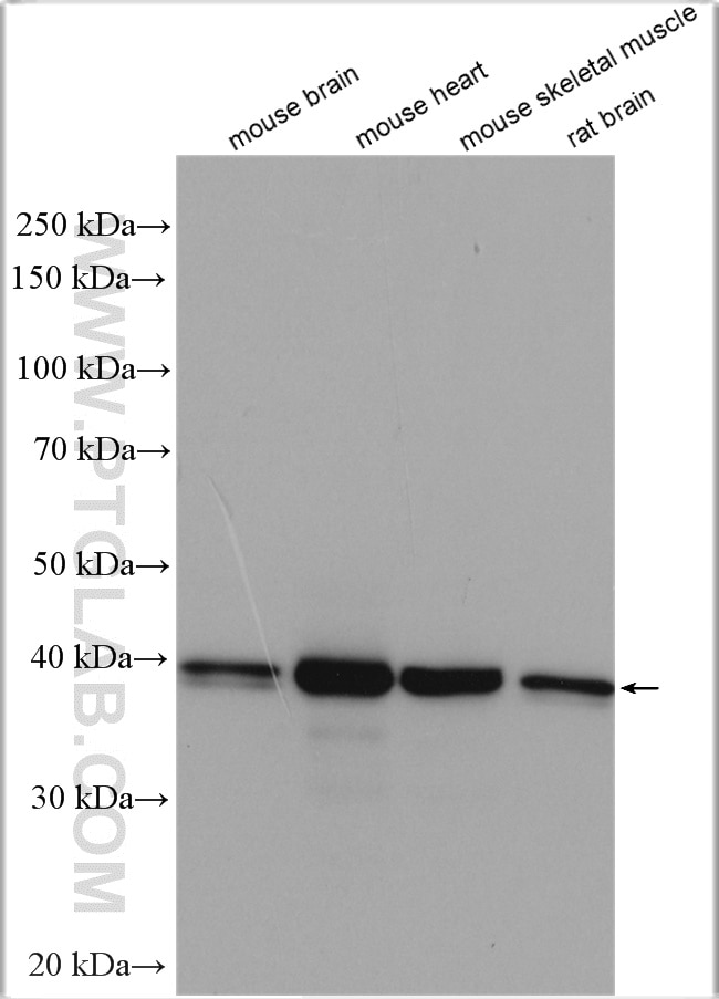 Western Blot (WB) analysis of various lysates using TMOD1 Polyclonal antibody (10145-1-AP)