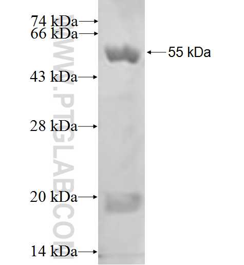 TMOD1 fusion protein Ag0192 SDS-PAGE