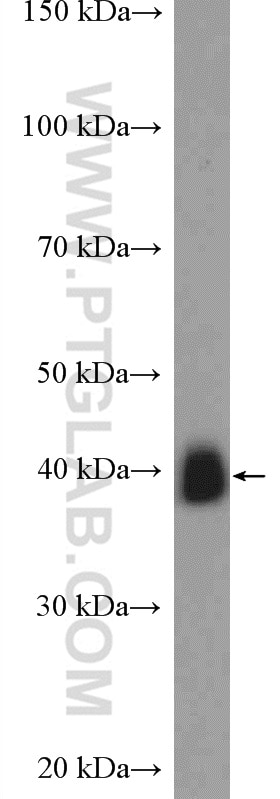 Western Blot (WB) analysis of mouse colon tissue using TMOD2 Polyclonal antibody (15262-1-AP)