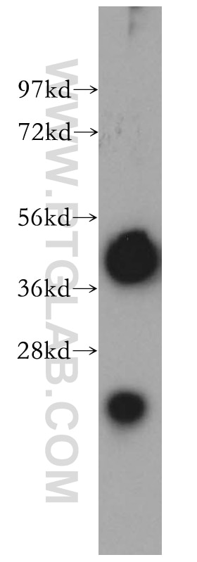 Western Blot (WB) analysis of human brain tissue using TMOD2 Polyclonal antibody (15262-1-AP)