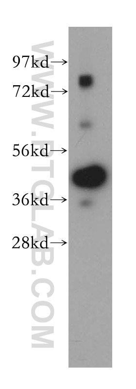 Western Blot (WB) analysis of human colon tissue using TMOD2 Polyclonal antibody (15262-1-AP)