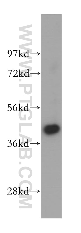 Western Blot (WB) analysis of human testis tissue using TMOD2 Polyclonal antibody (15262-1-AP)