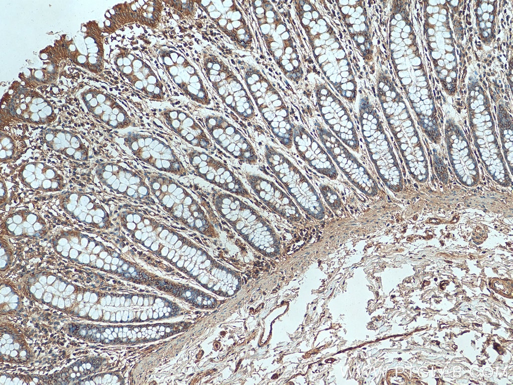 Immunohistochemistry (IHC) staining of human colon tissue using TMOD3 Polyclonal antibody (12521-1-AP)