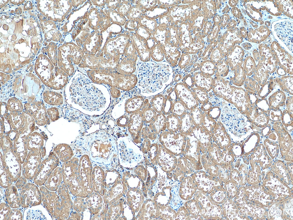 Immunohistochemistry (IHC) staining of human kidney tissue using TMOD3 Polyclonal antibody (12521-1-AP)