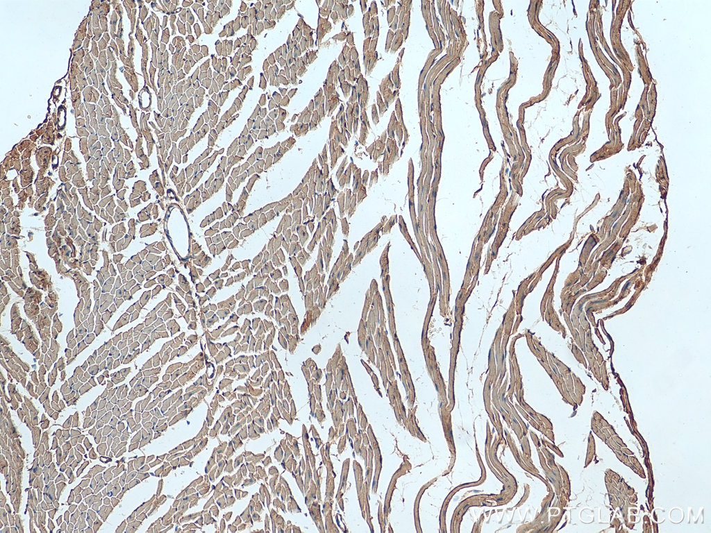 Immunohistochemistry (IHC) staining of mouse heart tissue using TMOD3 Polyclonal antibody (12521-1-AP)