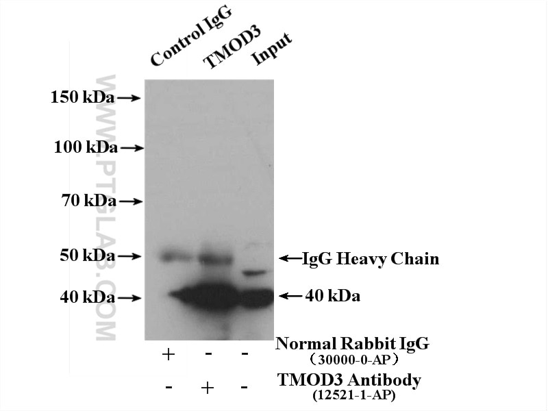 Immunoprecipitation (IP) experiment of Jurkat cells using TMOD3 Polyclonal antibody (12521-1-AP)