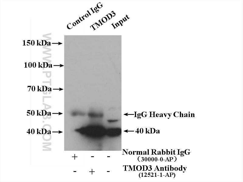 Immunoprecipitation (IP) experiment of Jurkat cells using TMOD3 Polyclonal antibody (12521-1-AP)