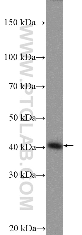 Western Blot (WB) analysis of mouse kidney tissue using TMOD3 Polyclonal antibody (12521-1-AP)