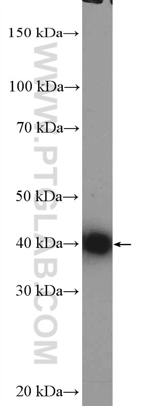 Western Blot (WB) analysis of Jurkat cells using TMOD3 Polyclonal antibody (12521-1-AP)
