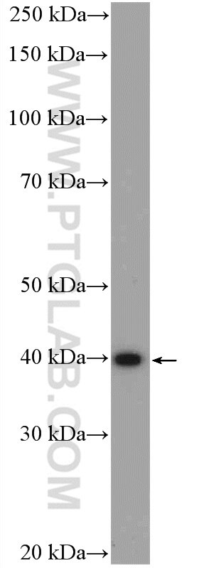 Western Blot (WB) analysis of mouse brain tissue using TMOD3 Polyclonal antibody (12521-1-AP)