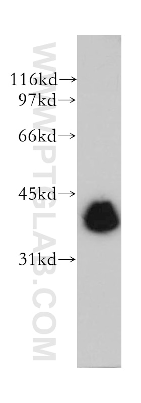 Western Blot (WB) analysis of human heart tissue using TMOD3 Polyclonal antibody (12521-1-AP)
