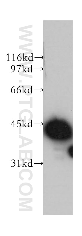 Western Blot (WB) analysis of human kidney tissue using TMOD3 Polyclonal antibody (12521-1-AP)