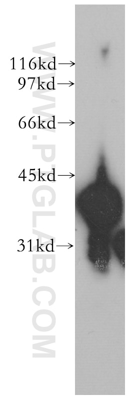 Western Blot (WB) analysis of human lung tissue using TMOD3 Polyclonal antibody (12521-1-AP)