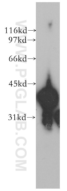 Western Blot (WB) analysis of human lung tissue using TMOD3 Polyclonal antibody (12521-1-AP)