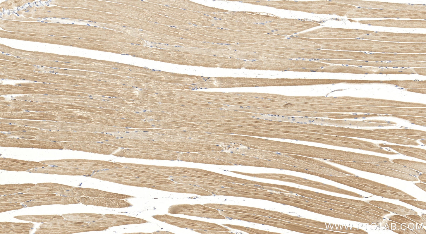 Immunohistochemistry (IHC) staining of mouse skeletal muscle tissue using TMOD4 Polyclonal antibody (11753-1-AP)
