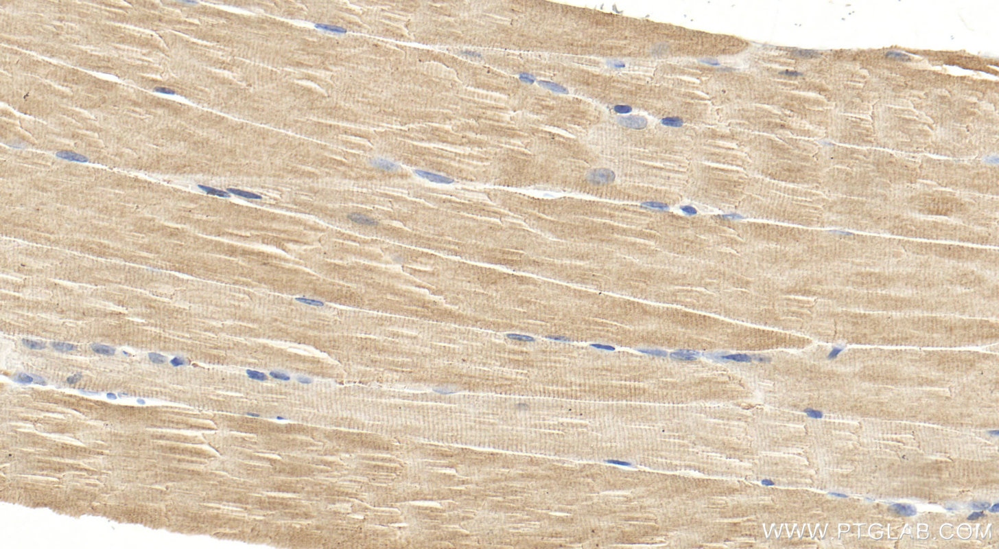 Immunohistochemistry (IHC) staining of mouse skeletal muscle tissue using TMOD4 Polyclonal antibody (11753-1-AP)