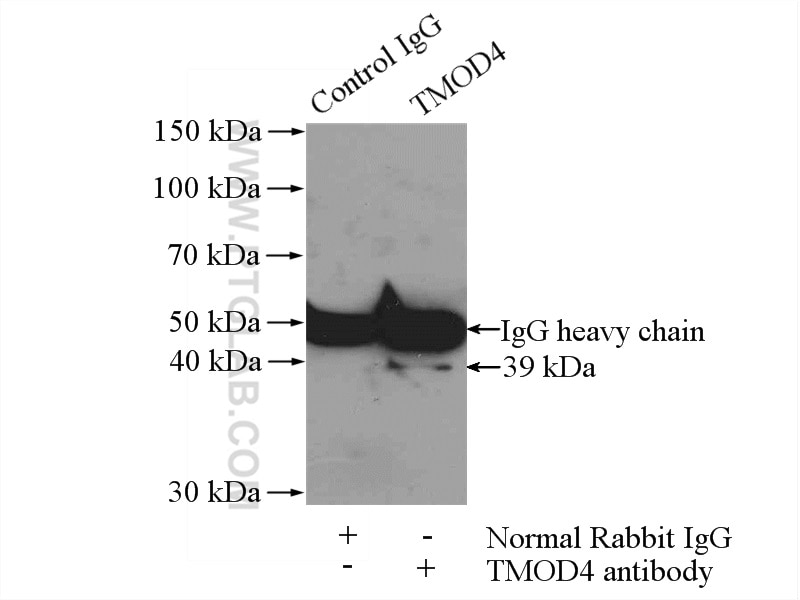 Immunoprecipitation (IP) experiment of mouse skeletal muscle tissue using TMOD4 Polyclonal antibody (11753-1-AP)