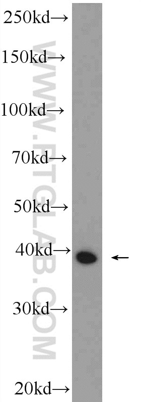Western Blot (WB) analysis of mouse skeletal muscle tissue using TMOD4 Polyclonal antibody (11753-1-AP)